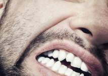 كم عدد ضروس العقل وكيف تعالج مشاكلها