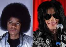 8 صور جديدة تكشف عمليات تغيير ملامح مايكل جاكسون