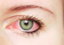 ما أسباب ارتفاع ضغط العين الداخلي؟