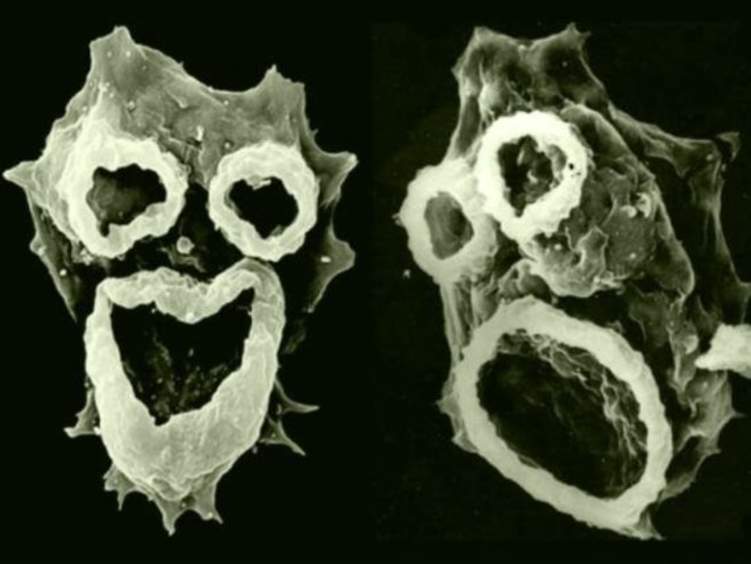 "الأميبا الآكلة للدماغ "خطر جديد يهدد العالم