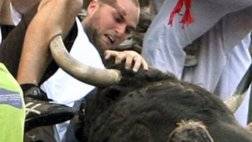 bull fighting injuries-اصابات مصارعة الثيران